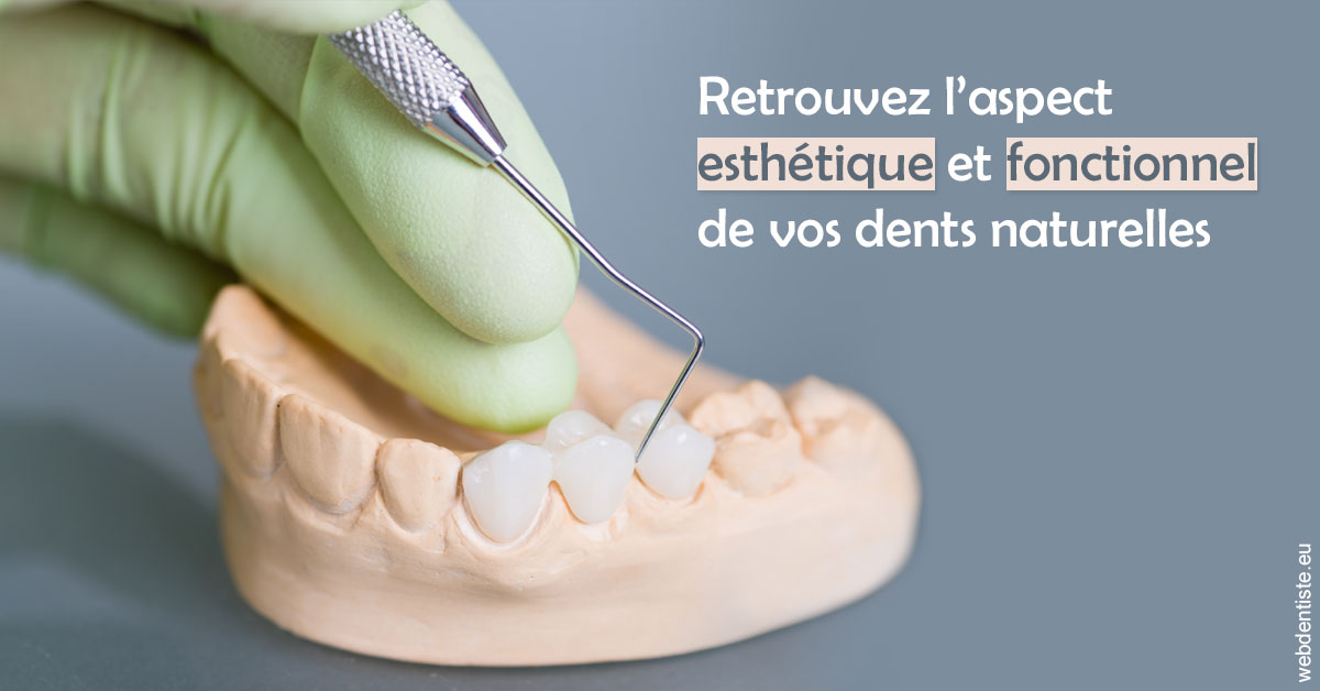 https://dr-simon-helene.chirurgiens-dentistes.fr/Restaurations dentaires 1