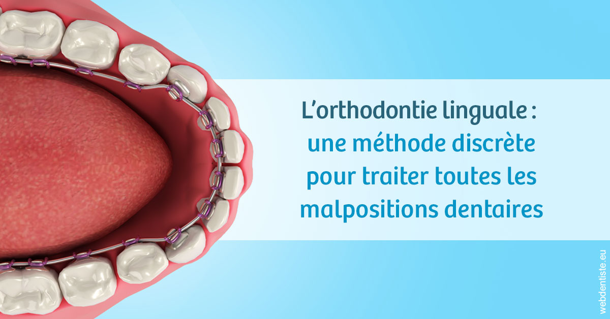 https://dr-simon-helene.chirurgiens-dentistes.fr/L'orthodontie linguale 1