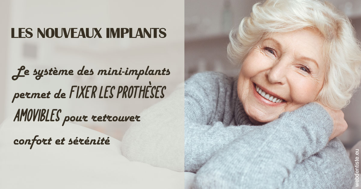 https://dr-simon-helene.chirurgiens-dentistes.fr/Les nouveaux implants 1
