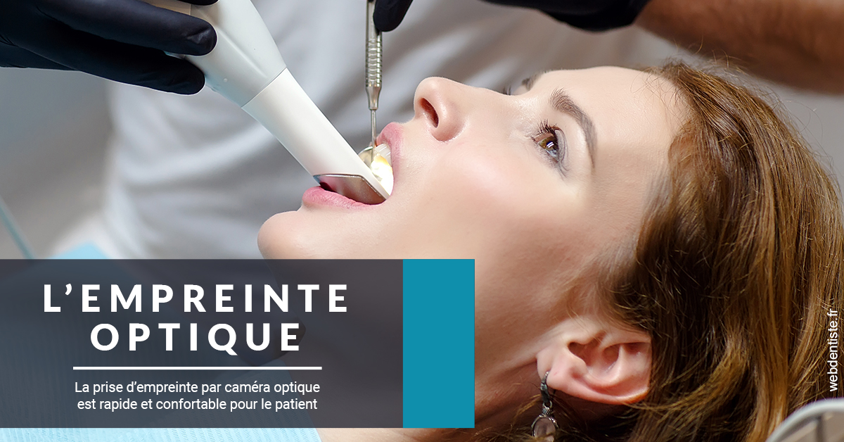 https://dr-simon-helene.chirurgiens-dentistes.fr/L'empreinte Optique 1