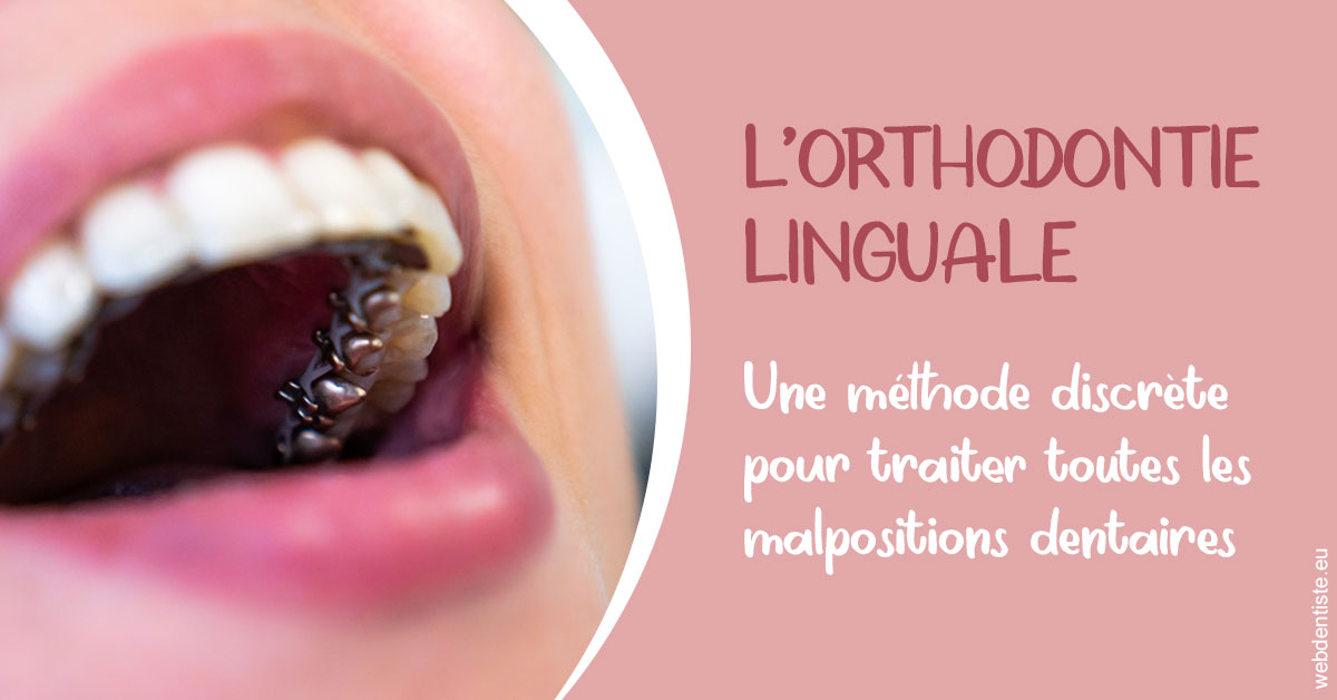https://dr-simon-helene.chirurgiens-dentistes.fr/L'orthodontie linguale 2