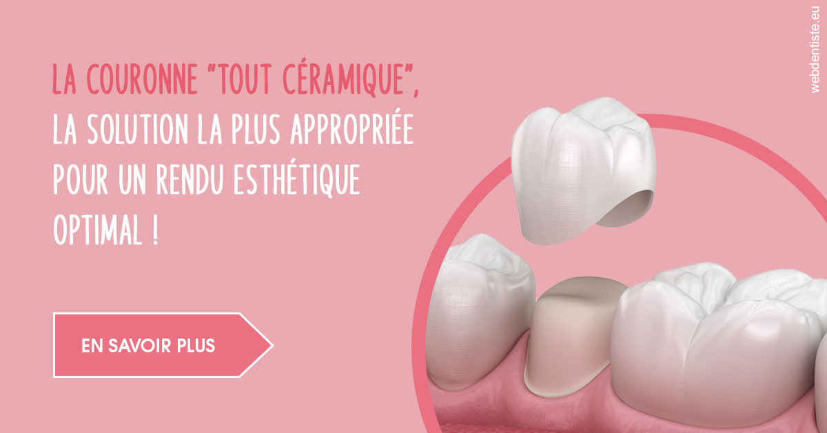 https://dr-simon-helene.chirurgiens-dentistes.fr/La couronne "tout céramique"
