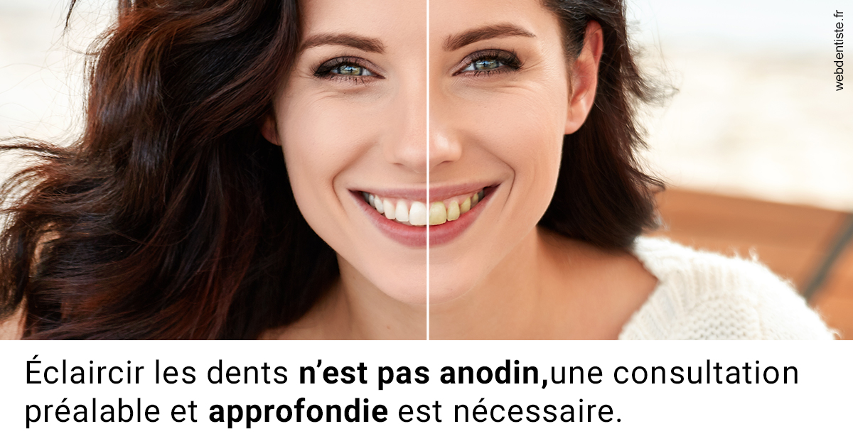 https://dr-simon-helene.chirurgiens-dentistes.fr/Le blanchiment 2