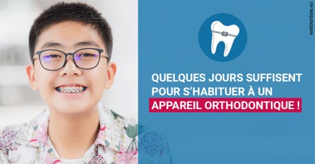 https://dr-simon-helene.chirurgiens-dentistes.fr/L'appareil orthodontique