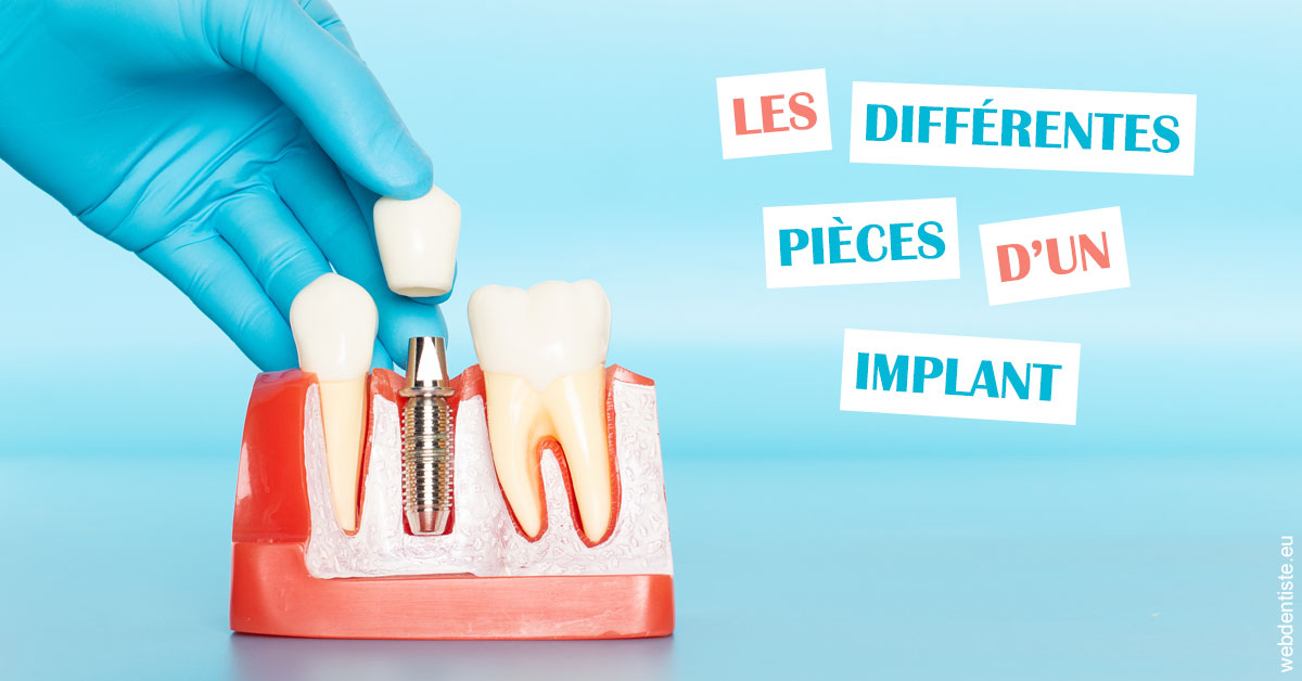 https://dr-simon-helene.chirurgiens-dentistes.fr/Les différentes pièces d’un implant 2