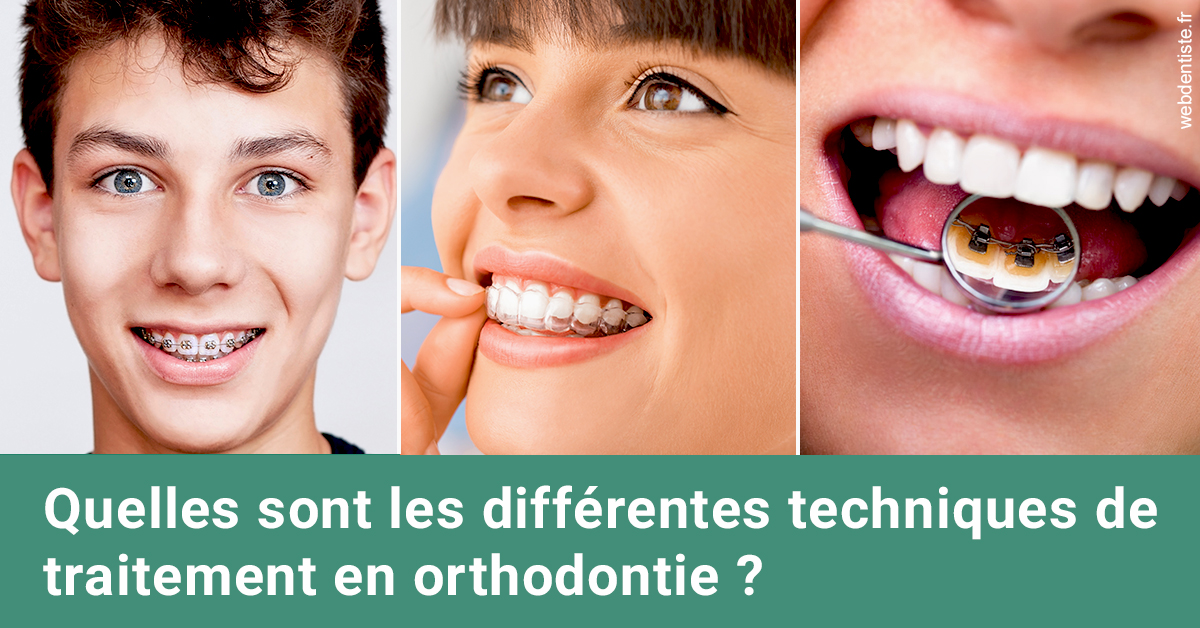 https://dr-simon-helene.chirurgiens-dentistes.fr/Les différentes techniques de traitement 2