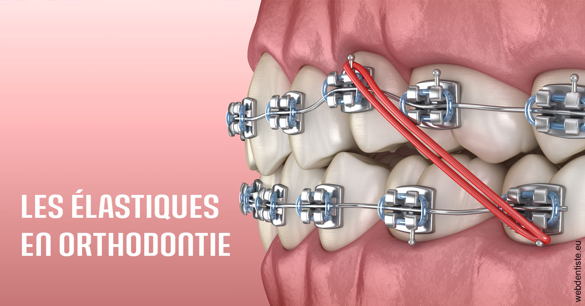 https://dr-simon-helene.chirurgiens-dentistes.fr/Elastiques orthodontie 2