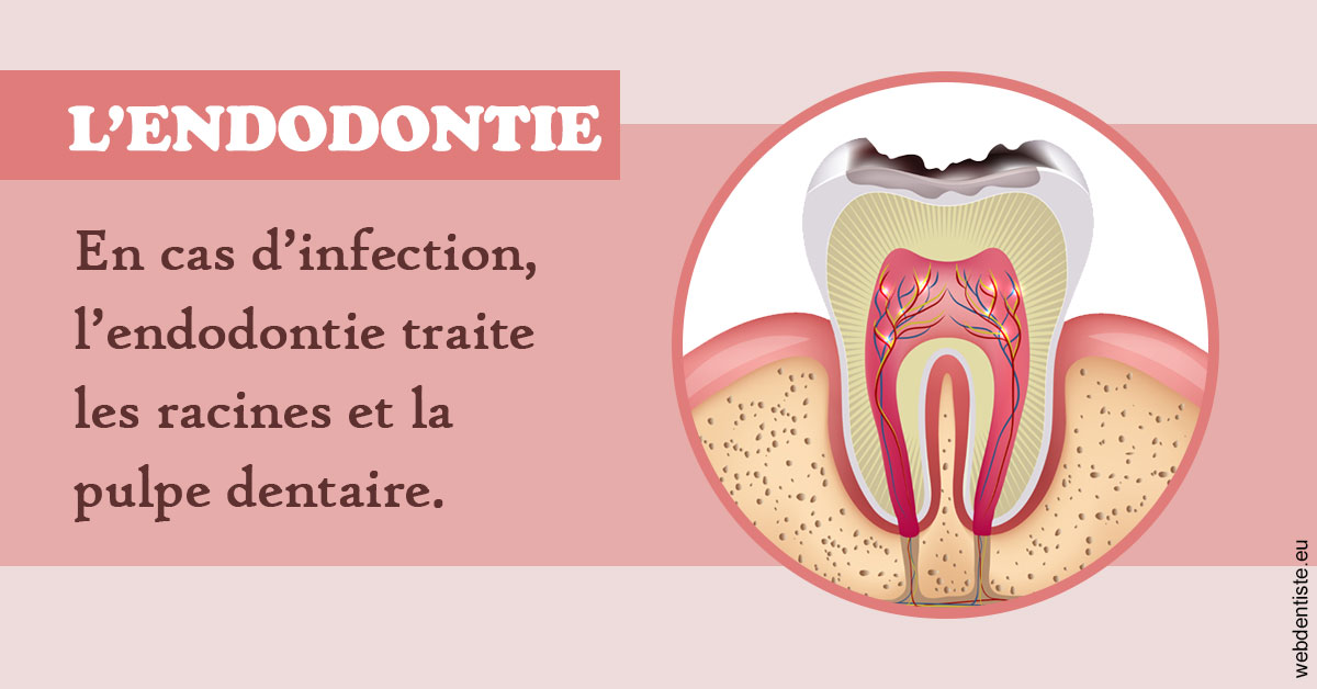 https://dr-simon-helene.chirurgiens-dentistes.fr/L'endodontie 2
